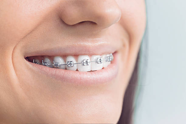 Why Choose Us for Your Dental Needs in Sterling City, TX